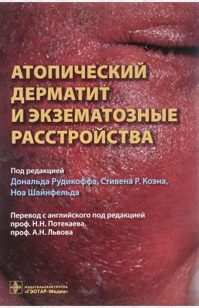 Под ред.Рудикоф Атопический дерматит и экзематозные расстройства, 978-5-9704-4088-9