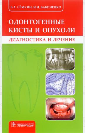 В. А. Сёмкин, И. И. Бабиченко Одонтогенные кисты и опухоли, 978-5-9704-4162-6