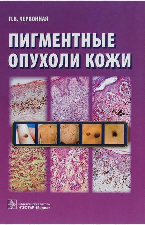 Л. В. Червонная Пигментные опухоли кожи, 978-5-9704-3673-8